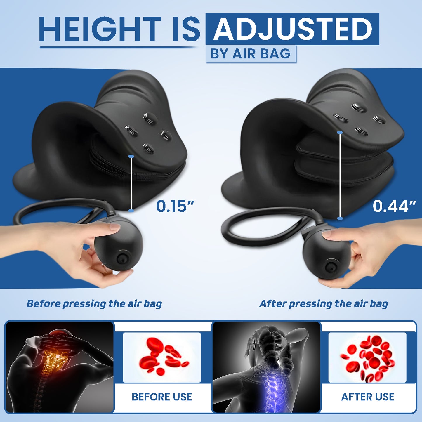 CerviFix - Relieve & Align Your Neck At Home