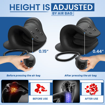 CerviFix - Relieve & Align Your Neck At Home